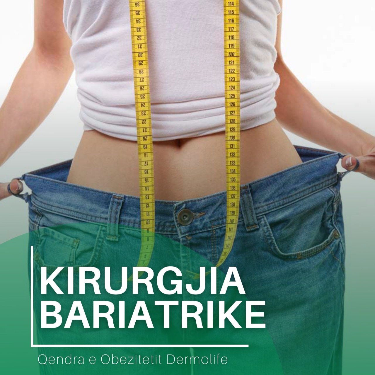 gastric sleeve Tirane